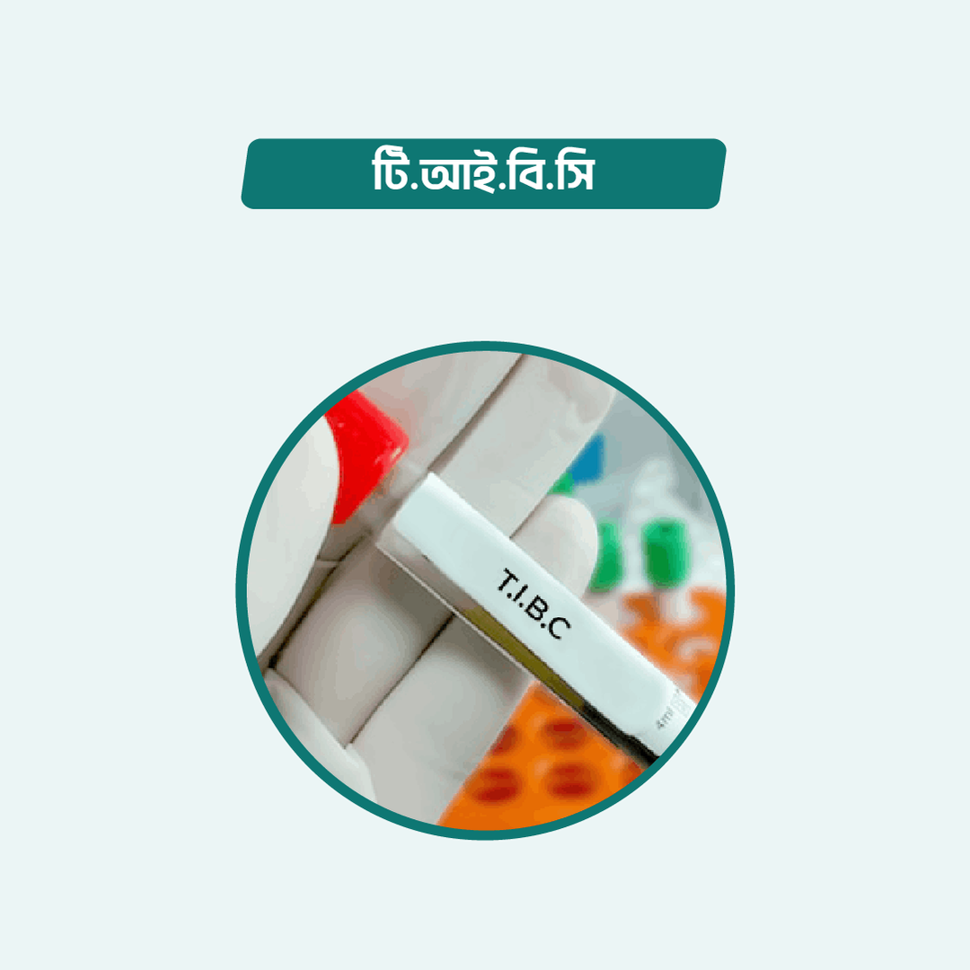 T. I. B. C. test Online in Dhaka | Arogga Online Lab