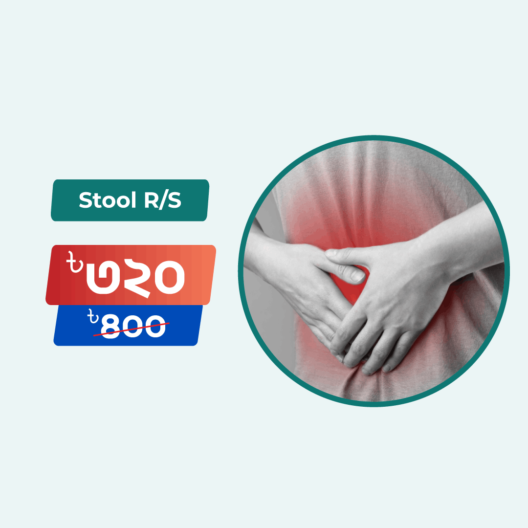 Stool R/M/E test Online in Dhaka | Arogga Online Lab