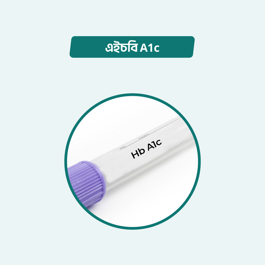 hba1c-arogga-online-lab