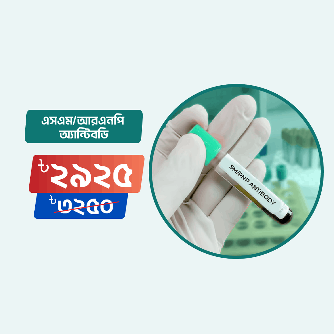 Sm/Rnp Antibody test Online in Dhaka | Arogga Online Lab