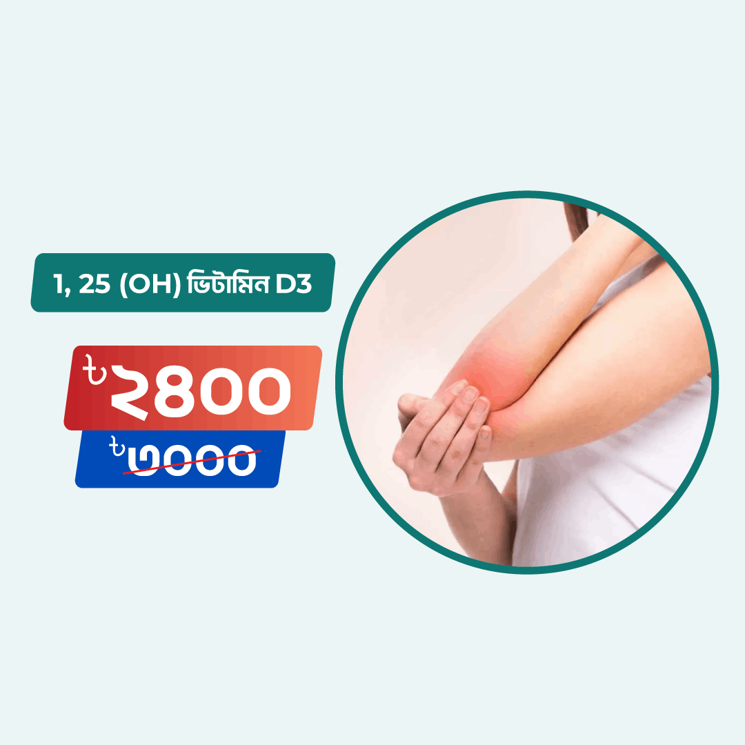 1, 25 (Oh) Vitamin D3 test Online in Dhaka | Arogga Online Lab