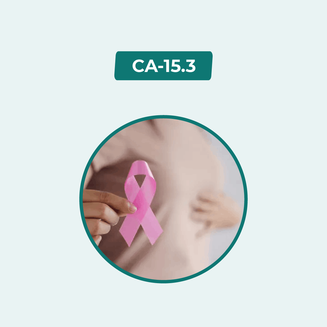 CA 15-3 test Online in Dhaka | Arogga Online Lab