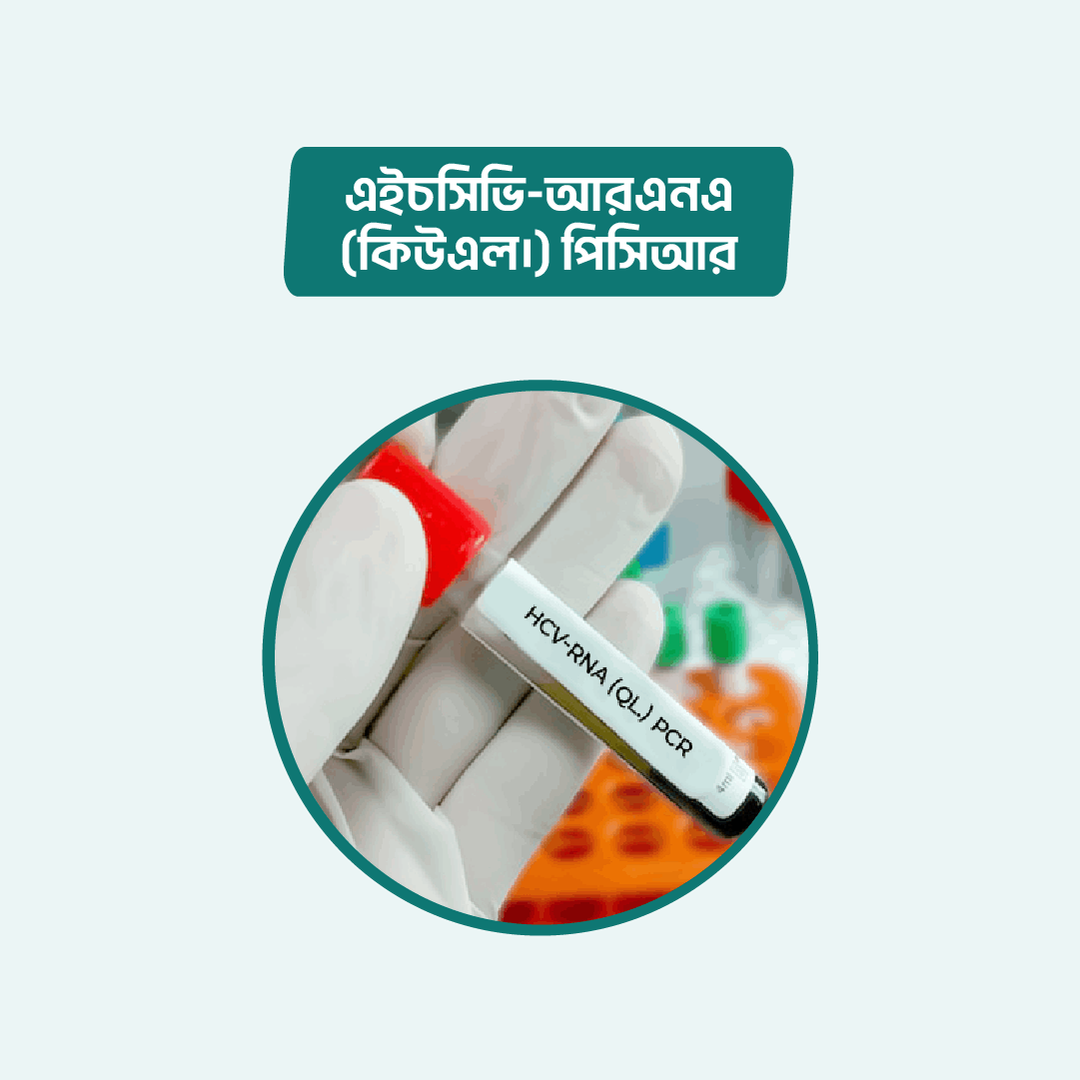 hcv-rna-ql-pcr-arogga-online-lab