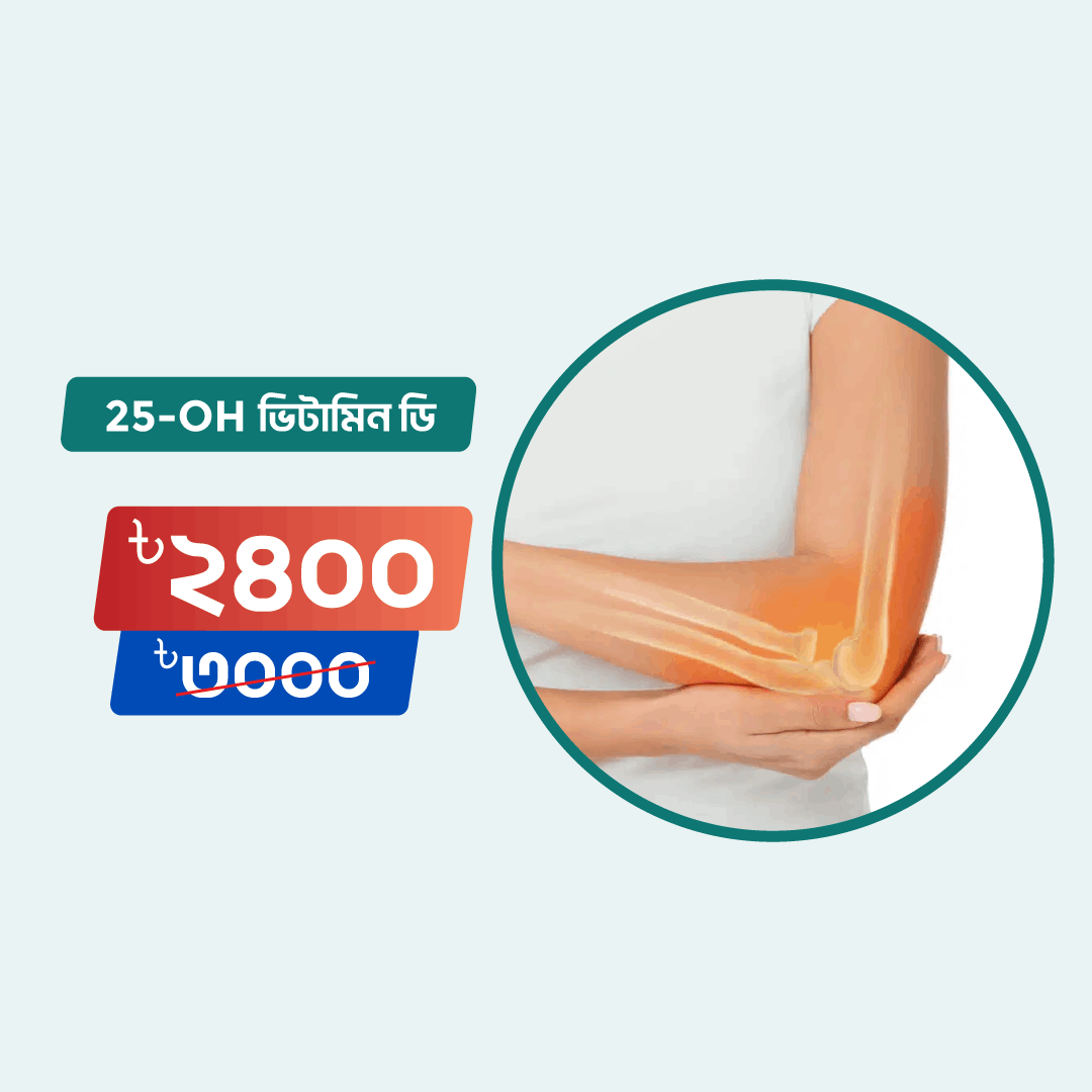 25-Oh Vitamin D test Online in Dhaka | Arogga Online Lab