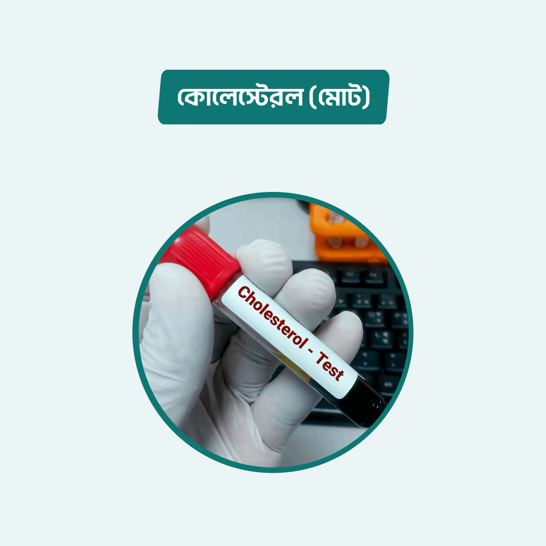 cholesterol-total-arogga-online-lab