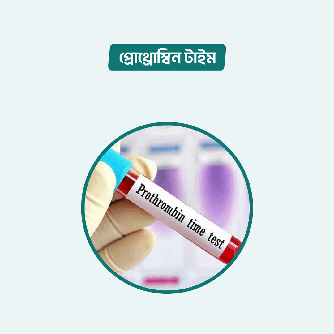 Prothrombin Time (INR) test Online in Dhaka | Arogga Online Lab