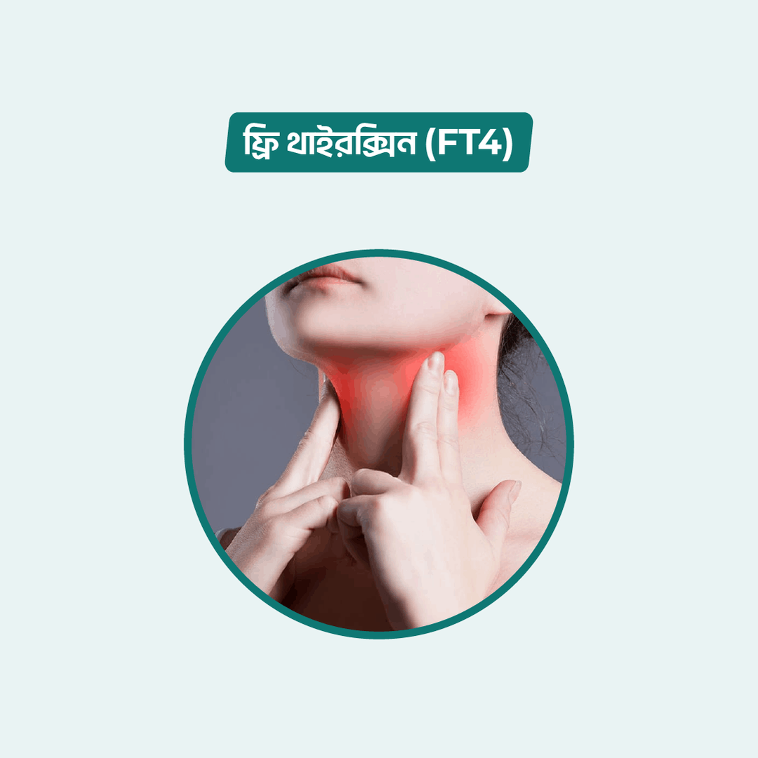 Free T4 (FT4) test Online in Dhaka | Arogga Online Lab