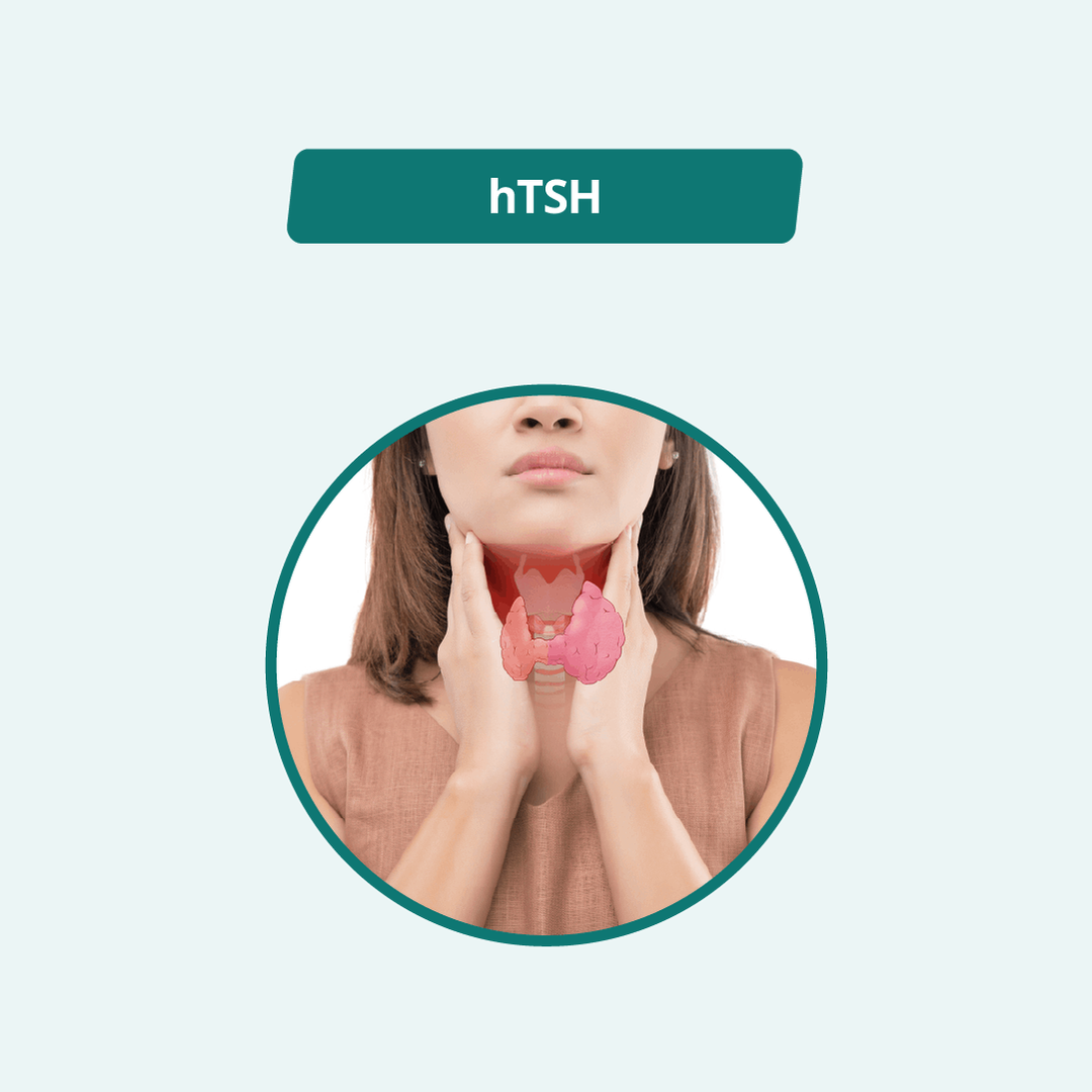 TSH test Online in Dhaka | Arogga Online Lab